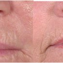 카프로닥터 이미지