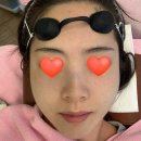 서울엔비뇨기과의원 | 내돈내산)선릉 힐비뇨기과 잡티제거 4개월 후기, 예약꿀팁, 비용, 관리방법