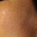 연세고은의원 이미지