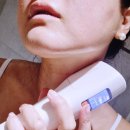 도트인뷰티 | 홈쎄라 피부탄력기기 사용방법 효과 리얼후기