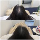 헤어클리아 | 원흥 가르마 두피문신 브로우인 2차 3차 후기 자연스러움 끝판왕