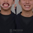 보일치과기공소 이미지