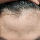 예산베스트신경외과의원 | 충청남도 예산군 피부과 전문 병원 후기 좋은곳 추천 6곳