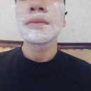 해피메디 | 해피메디 턱수염 제모 2회차 후기