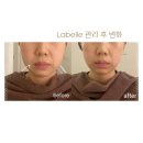 장위동 피부관리 강남, 청담동 피부과 실장의 10년 경력 노하우 라벨르