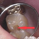케이치과기공소 | 어금니가 아파요 검진받고 싶어요 - 상도동치과 장승배기치과