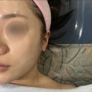 태성골프아카데미 | 부산강서구피부관리 / 이지더테라피 물방울 리프팅 : 피부가 달라진 리얼후기!