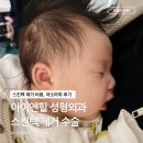 온리아이성형외과의원 | 남양주 다산 아이앤힐 성형외과 신생아 스킨텍 제거 수술 비용 후기