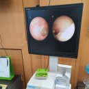독일스타보청기 이미지