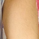 천안재활병원 이미지