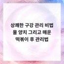 범석영치과의원 네이버블로그