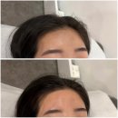 GS25부평본점 | 부평 제이미뷰티끄 헤어라인&amp;이마왁싱 후기