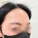 문썹 | 화정눈썹잔흔제거 자연스럽게 정리한 화정제거 문썹 브로우 후기