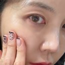 더미스랩 인터내셔널 | 여드름 앰플 더미스랩 아크네이트 밸런스 앰플 후기