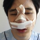 조이비인후과의원 네이버블로그