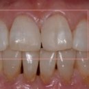 스마일홍치과의원 이미지