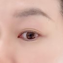 오렌즈비젼센터홍대점 이미지