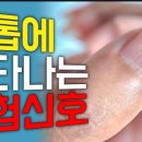 손톱별 이미지