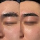 동양메디컬 | 처음 받아본 영통 남자 왁싱 후기, 생각보다 훨씬 괜찮았다