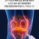 줄기세포