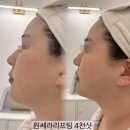 슈피부관리실