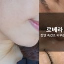 르베라천안점