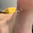 [전주 발 각질] 신시가지 발 각질 관리 &lt;던네일&gt; 패디플레닝 후기