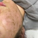 알라딘 스킨케어 | 천안 피부관리 내돈내산 오마주21스킨케어 알라딘필링 잘하는곳 후기