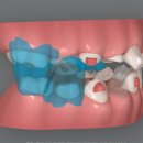 서울아미치과교정과치과의원 | 송도 치아교정은? 내가 아름다워질 그 곳, 서울아미치과교정과
