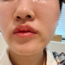 대흥동물병원 | 이대 피부관리 큐어에스테틱 울트라쎄라 후기! 병원보다 꼼꼼한 림프순환관리로 갸름해진 얼굴