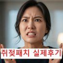 진실약국 | 쥐젖패치 실제 효과 후기 진실