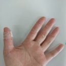 우태하한승경피부과의원 | 우태하 한승경 피부과 본원 숙대 입구 방문 후기