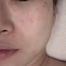 오로라 피부관리 | [용인/죽전] 죽전역 에스테틱 보정동 에스테틱 머바르니에스테틱 오로라 피부관리 후기