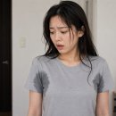 날샘 바이오 | 받았다. 내돈내산 두 달차 찐후기(가격, 시술과정 상세설명, 바이오본드 회복기간, 시술시기추천)