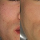 토마스의원 | 남자 피부 노화가 더 빨리 오는 이유, 언제부터 급격히 늙어 보일까?_ 남자 전문 피부과 추천 시술