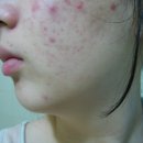 아쿠아 소프트 이미지