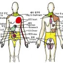 통증 지각력(pain sensations)과 전이통(referred pain) 이미지