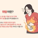 스트레스성위염(신경성 위염) 원인, 증상, 관리방법까지 이미지