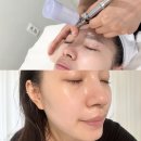 암사어린이집 | 강동구 암사 피부관리 추천 구나바이스킨 맞춤 일대일 맞춤관리 윤곽관리 모공 플라즈마 후기