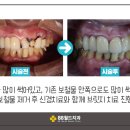 88월드치과의원 네이버블로그