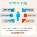 웅선의원 | 탈모 고민~ 안드로겐형 탈모치료 어떤 약물치료가 효과적일까?