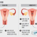 수정-1 이미지