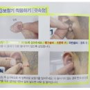 인애의료기 | 부천보청기 믿을 수 있는 곳에서!