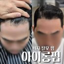 윤가헤어 | 탈모 파마 아이롱펌 남자 헤어스타일 교정으로 자연스러운 탈모 펌 완성