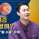 전립선비대증도 로봇 수술? 정확한 절제 가능한 아쿠아블레이션이란? | 질병백과 이미지