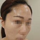 아이 엠 에스테틱 | 범어동윤곽관리 아이엠에스테틱 윤곽관리 후기