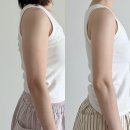 라인컷 | 대구 지방분해주사 팔뚝 5회차 라인 변화 하프컷 효과 후기