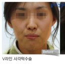 디오메디 이미지