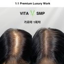 강동-천호-2468 | 강동탈모관리 정수리 가르마 두피반영구 비타SMP