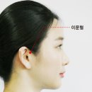 [촌철지압]‘이문혈’ -급성 외이도염, 중이염을 비롯하여 이명, 난청 등 각종 이과 질환에 이미지